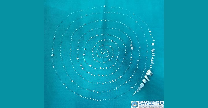 The Boy With 526 Teeth!