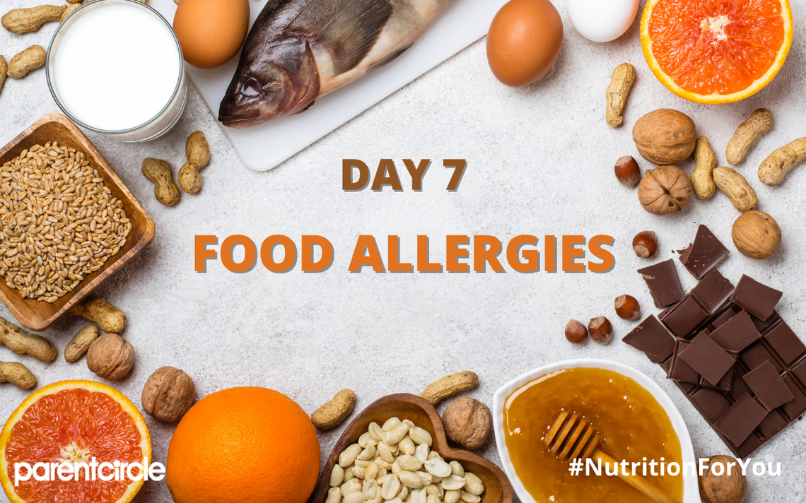DAY 7 | Food Allergies & Intolerances | Nutrition Week 2020