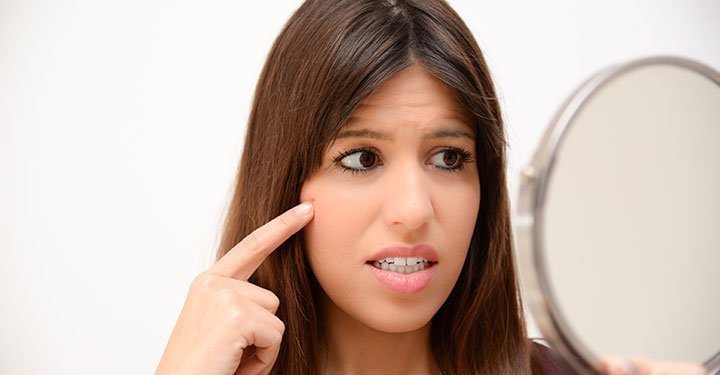 Home Remedies To Remove Dark Circles Under Eyes