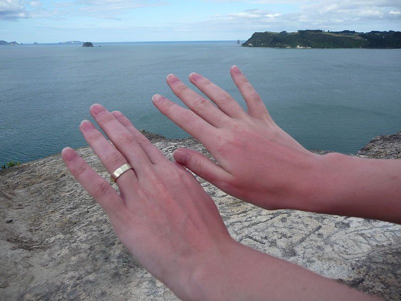 Summer Skin Problems And Their Remedies Summer Skin Problems And Their Remedies