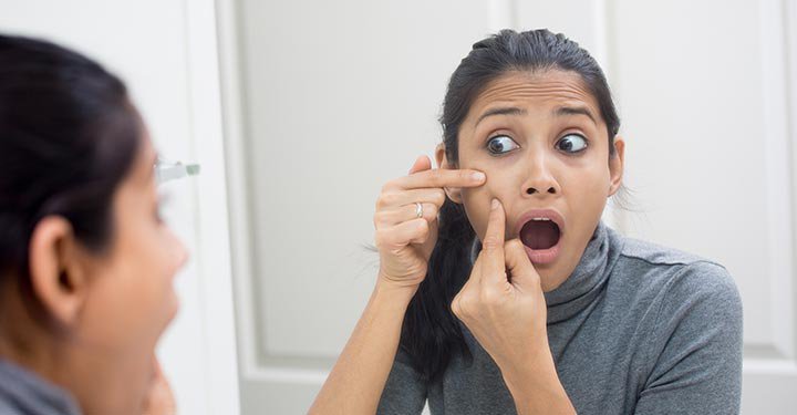 Acne After Childbirth: How To Deal With It