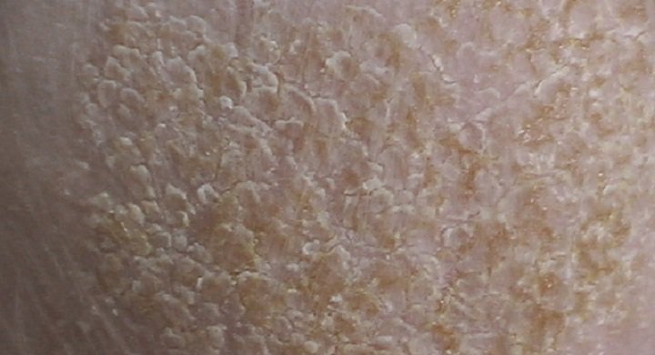 Skin Care for Babies And Kids