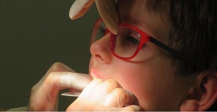 From Tooth Decay To Cavities To Thumb Sucking: 5 Common Dental Problems In Toddlers. 