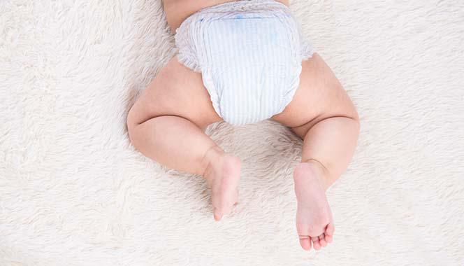 Diaper Rash: Tips For Prevention And Treatment
