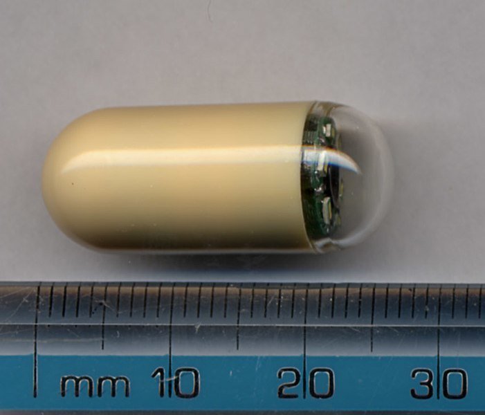 The Benefits of Capsule Endoscopy Vs Traditional Endoscopy